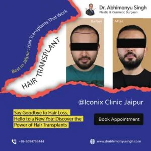 dr abhimanyu hair transplant